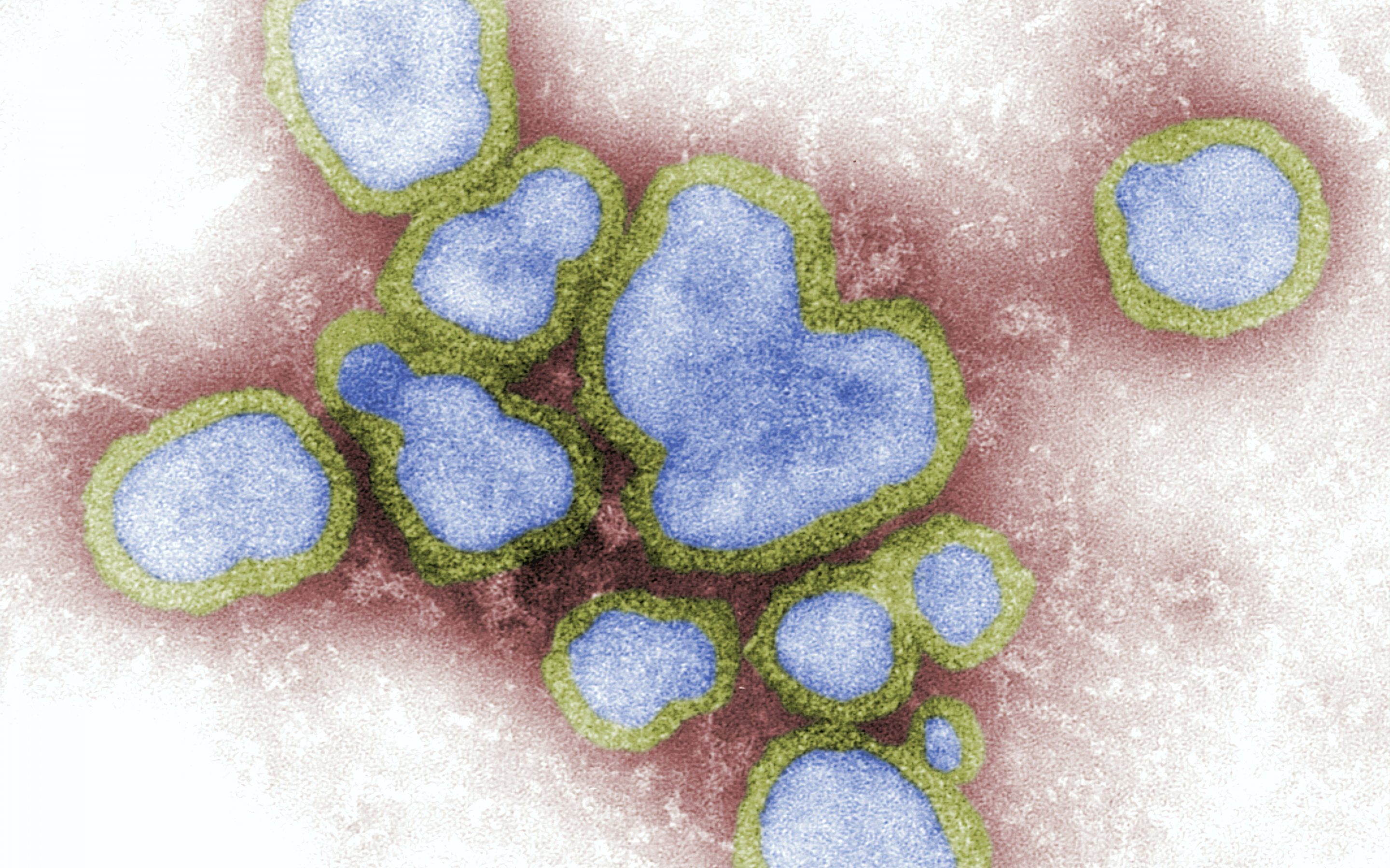 Pirmais iespējamais putnu gripas H10N3 gadījums cilvēkam